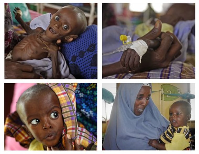 This composite image shows baby Minhaj Gedi Farah at various dates of his recovery at the International Rescue Committee hospital in Dadaab, Kenya. Minhaj arrived at the hospital on July 26 (top left). Below-left shows Minhaj on Aug. 6. Below-right shows Minhaj on Oct. 19. 